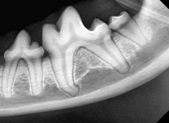 Radiografia dental de dente 1º molar mandibular esquerdo