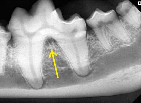 Radiografia dental de região de furca grau 1