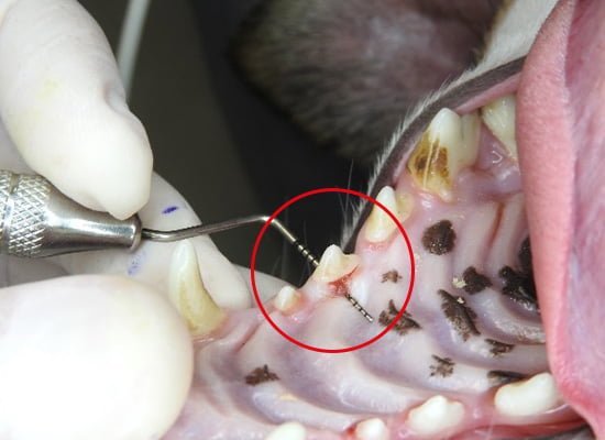 Lesão de furca grau 3 em dente pré-molar maxilar esquerdo