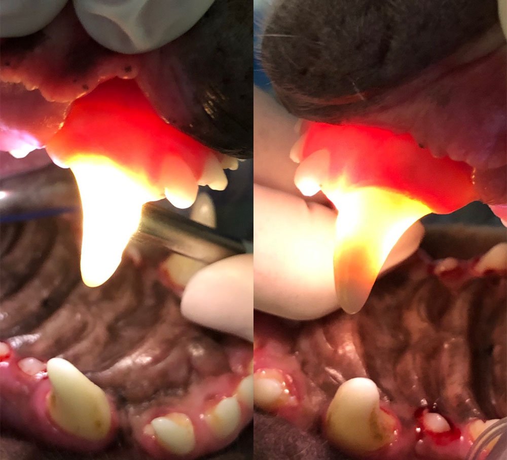 Transiluminação dentária mostrando dente vivo a esquerda e dente sem vitalidade á direita.